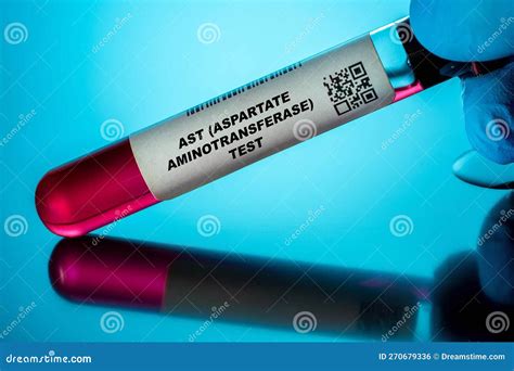 ast aspartate aminotransferase test.